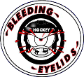 Bleeding Eyelids Hockey Webpage